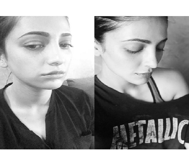 i-ve-had-plastic-surgery-i-m-not-ashamed-shruti-haasan-gives-a-befitting-reply-to-trolls