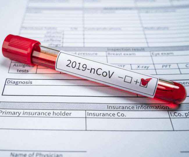 a negative blood type covid