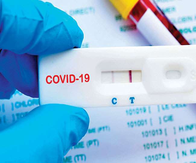  All Symptomatic Negative COVID 19 Cases Of RAT Should Be Mandatorily