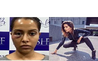'Dermatologist forced me...': Former Bigg Boss contestant Raiza Wilson's..