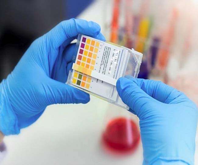 Explained How FELUDA Paper Strip Test Detects COVID 19 Hidden In Your 