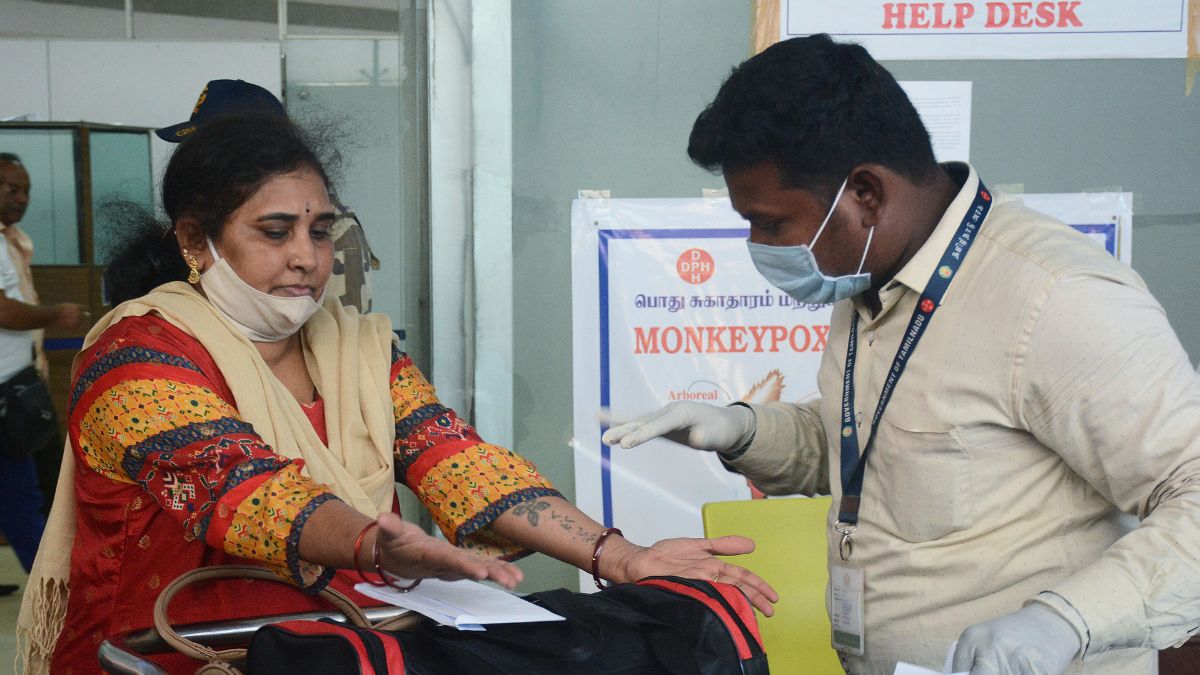 Use Sanitisers, Avoid Sharing Bedding: Centre's Dos And Don'ts On Monkeypox