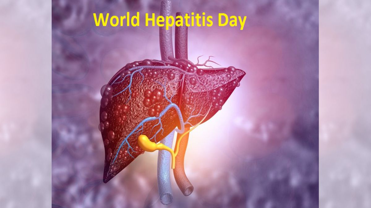 World Hepatitis Day 2022: Know Causes, Risks And Prevention Of This Liver Disease