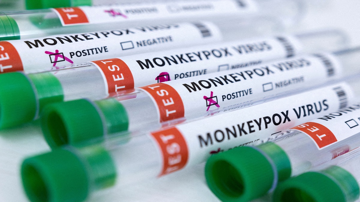 Third Monkeypox Case Detected In India After UAE Returnee Tests Positive In Kerala