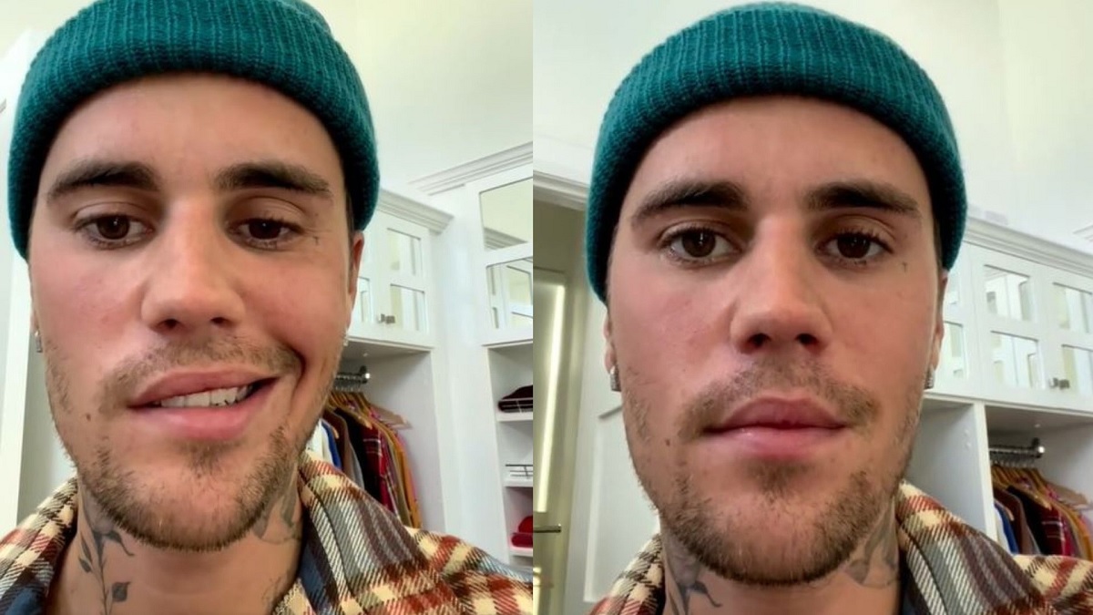 Justin Bieber Reveals He Is Suffering From Facial Paralysis, Says 'Eye Is Not Blinking' | WATCH
