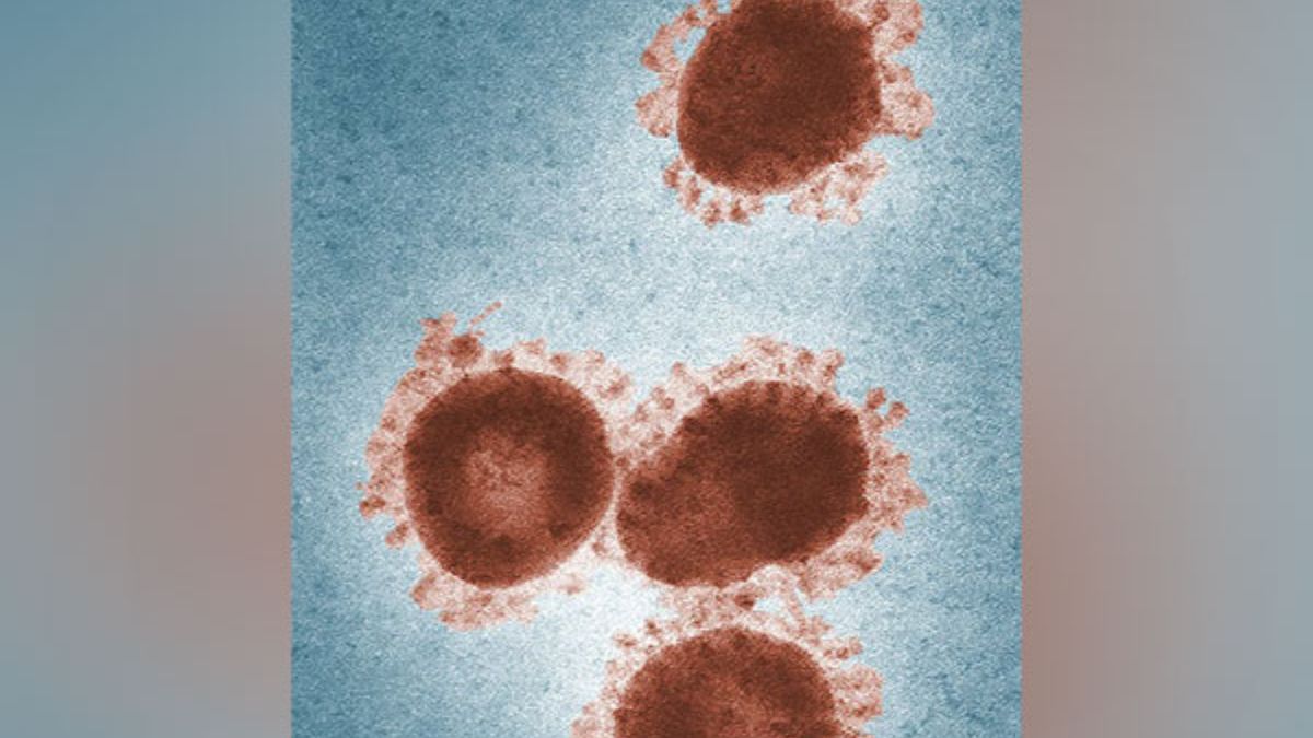 Zombie Virus 48,500YearOld ‘Zombie Virus’ Buried In Ice Revived By