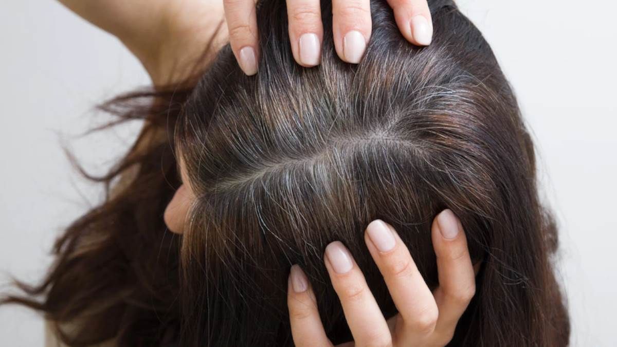 Medicine To Stop Premature Greying Of Hair