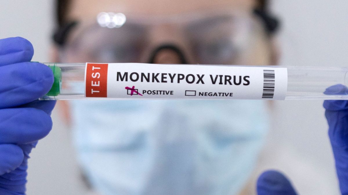 Oral, Nasal Samples Critical For Monkeypox Diagnosis: ICMR Study
