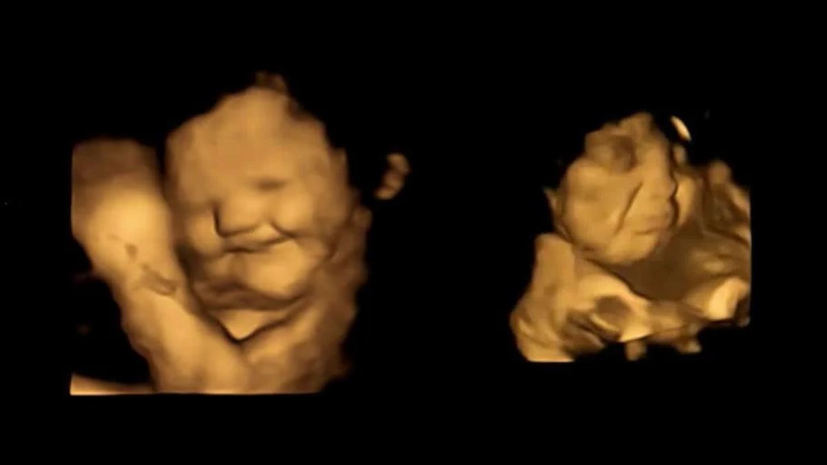 New Study Shows Unborn Babies Smiling And Reacting To Food Flavors Inside Mother's Womb