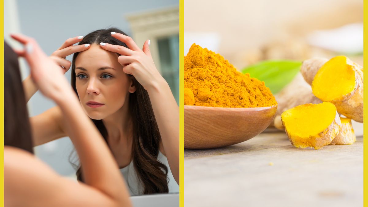 dark-forehead-4-natural-remedies-to-try-at-home-and-get-rid-of-pigmentation