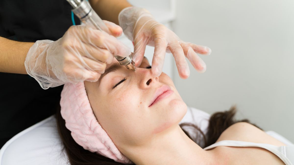 blackheads-removal-try-these-3-easy-and-home-remedies-to-get-rid-of-them