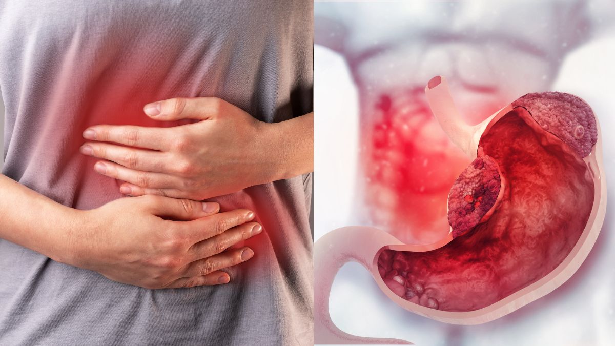 is-loss-of-appetite-a-sign-of-stomach-cancer-what-are-the-signs-and