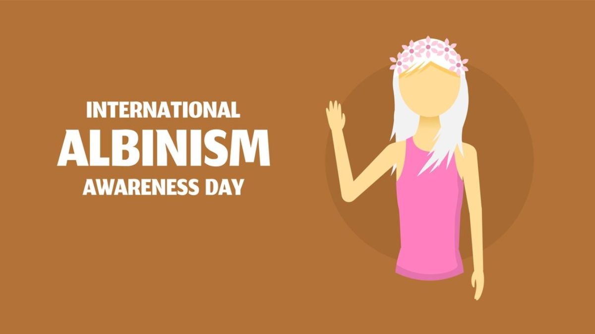 international-albinism-awareness-day-2023-date-history-significance