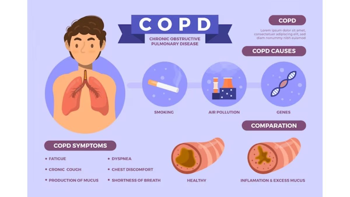 World COPD Day 2023: Expert Lists Ways To Reduce The Risk Of COPD