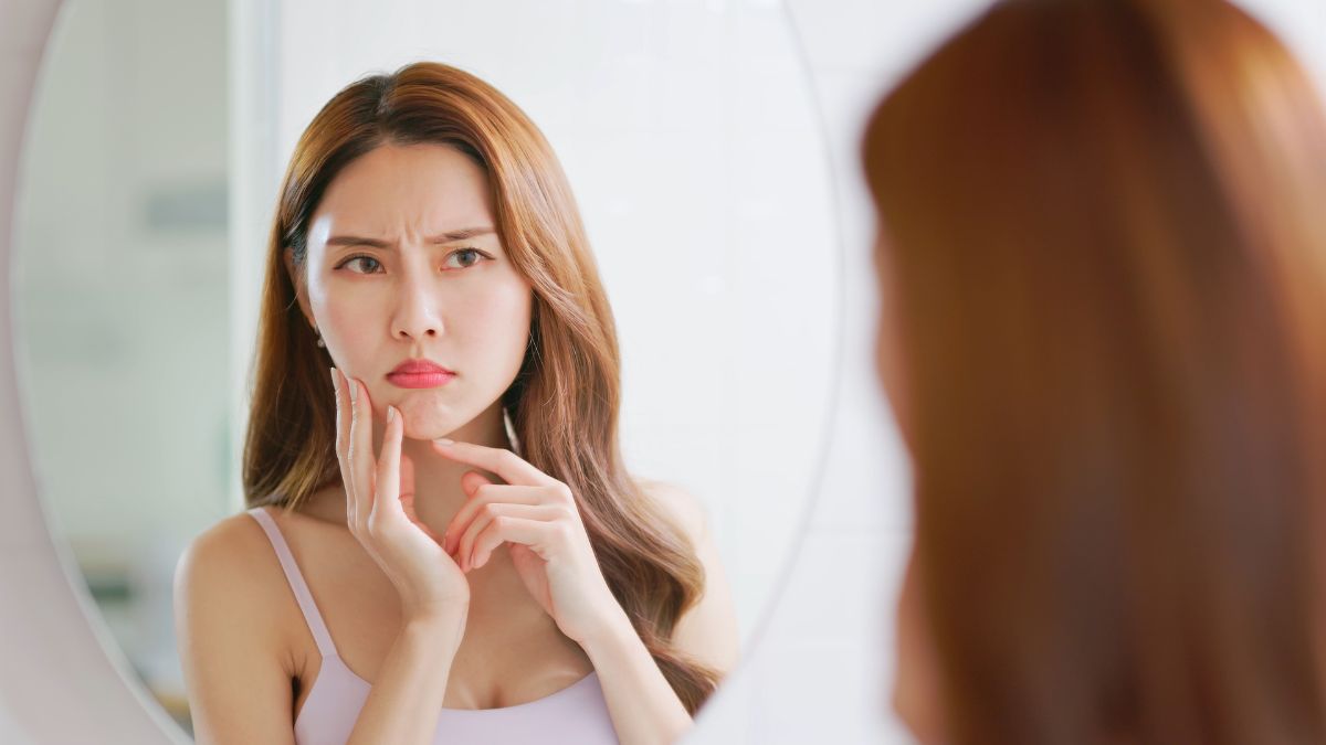 5-ways-prolonged-stress-may-be-affecting-your-skin-persistent-acne-to-ageing