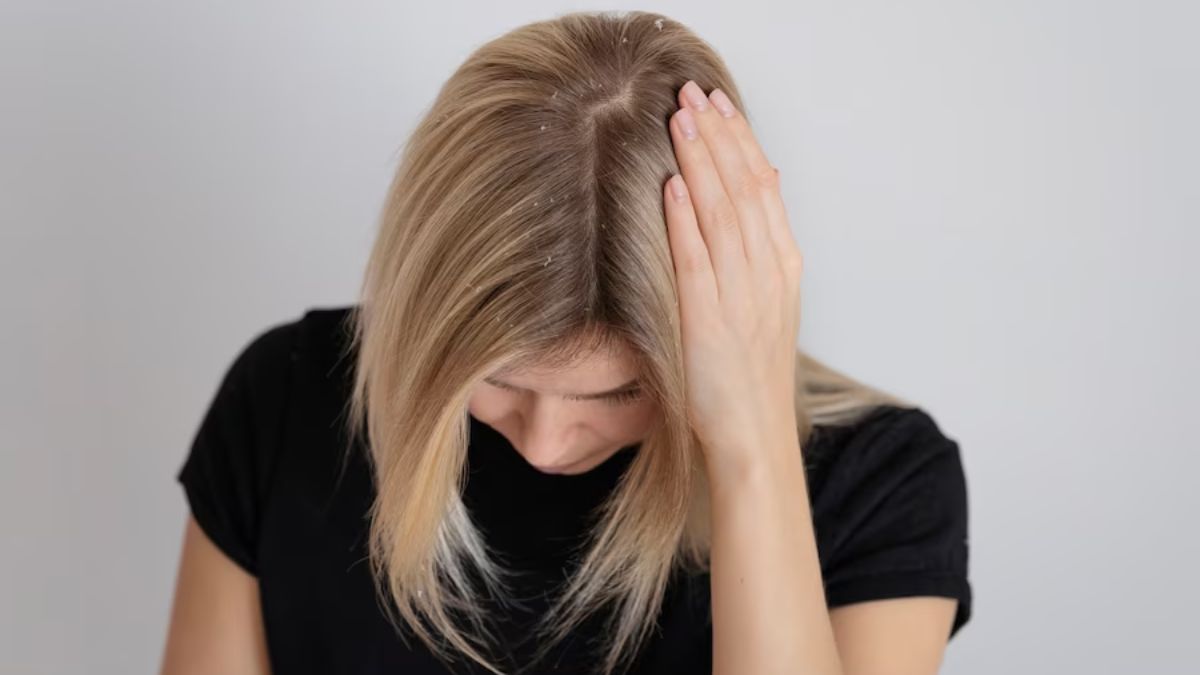 5-natural-ways-to-cleanse-your-scalp-and-prevent-haircare-woes