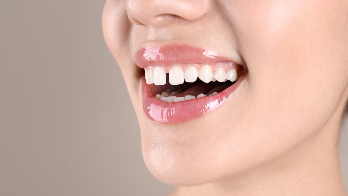 are-people-with-gap-between-front-teeth-lucky-know-via-astrological-perspective