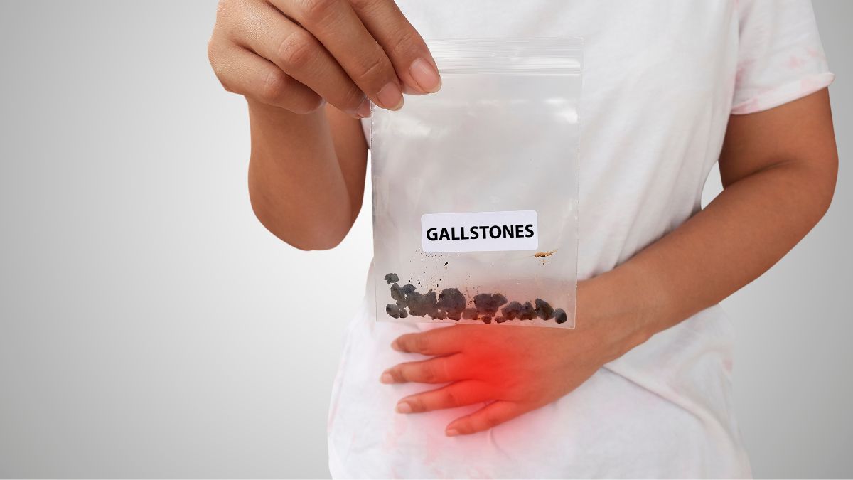 know-from-expert-what-are-gallstones-and-how-they-create-trouble-in-gallbladder