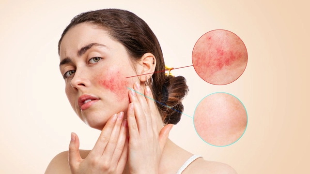 expert-explains-why-sensitive-skin-needs-special-care-guide-to-manage-sensitive-skin