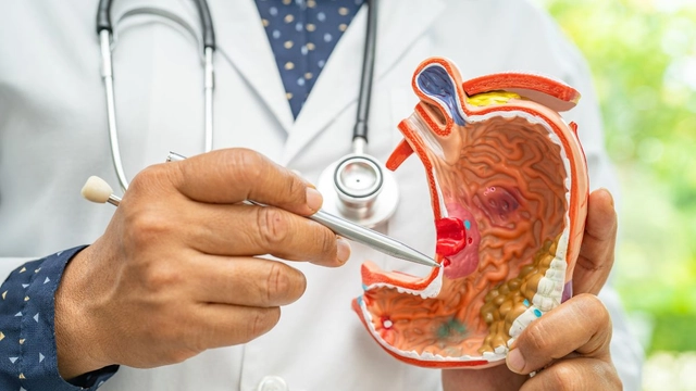 5-early-signs-and-symptoms-of-stomach-cancer-that-you-should-know-about