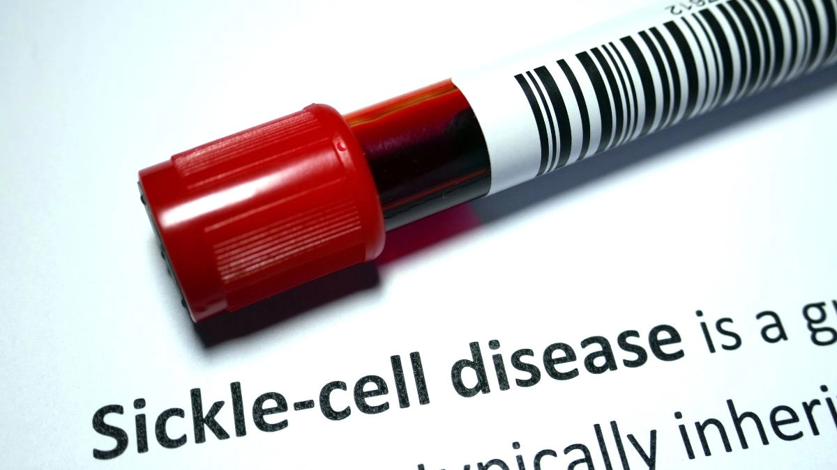 world-sickle-cell-day-2024-expert-explains-about-what-are-the-actually-triggers-of-a-sickle-cell-pain