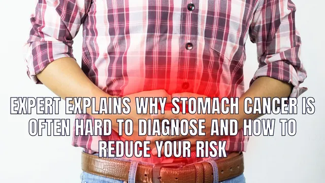 expert-explains-why-stomach-cancer-is-often-hard-to-diagnose-and-how-to-reduce-your-risk