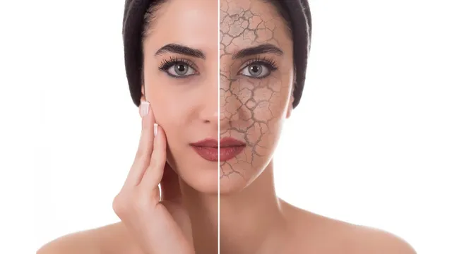 5-signs-that-your-skin-needs-your-immediate-attention-dark-spots-to-acne