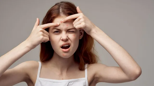 combatting-monsoon-acne-dermatologist-lists-essential-tips-for-clear-skin