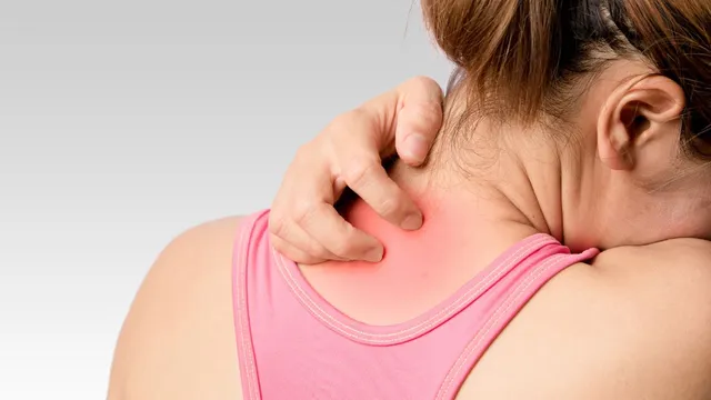 protect-your-skin-from-monsoon-rashes-and-infections-with-these-expert-tips