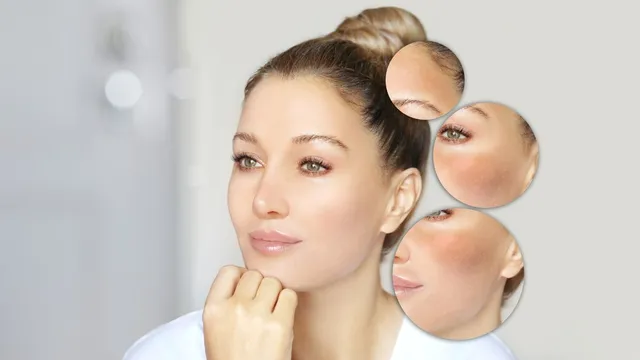 how-to-get-rid-of-black-spots-on-skin-expert-lists-effective-home-remedies