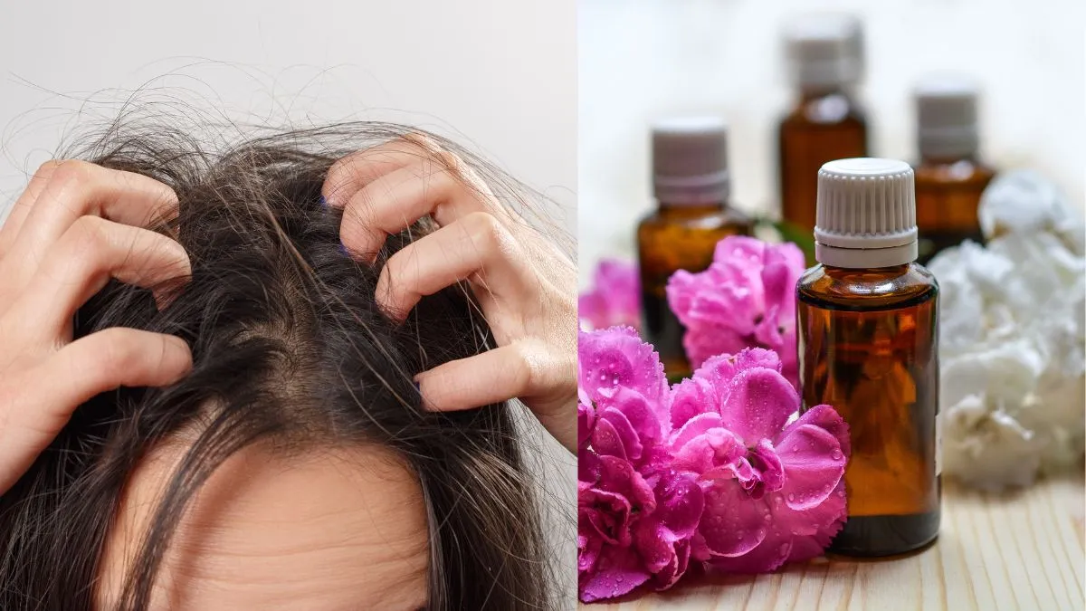 5-ways-to-manage-itchy-scalp-in-monsoon-using-natural-oils