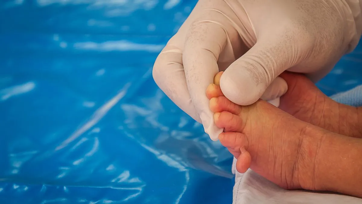karnataka-child-born-with-25-fingers-in-bagalkot-family-thanks-local-deity-for-divine-blessing