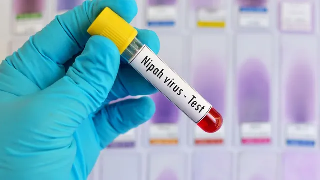 nipah-virus-how-contagious-is-this-virus-initial-symptoms-that-you-should-know