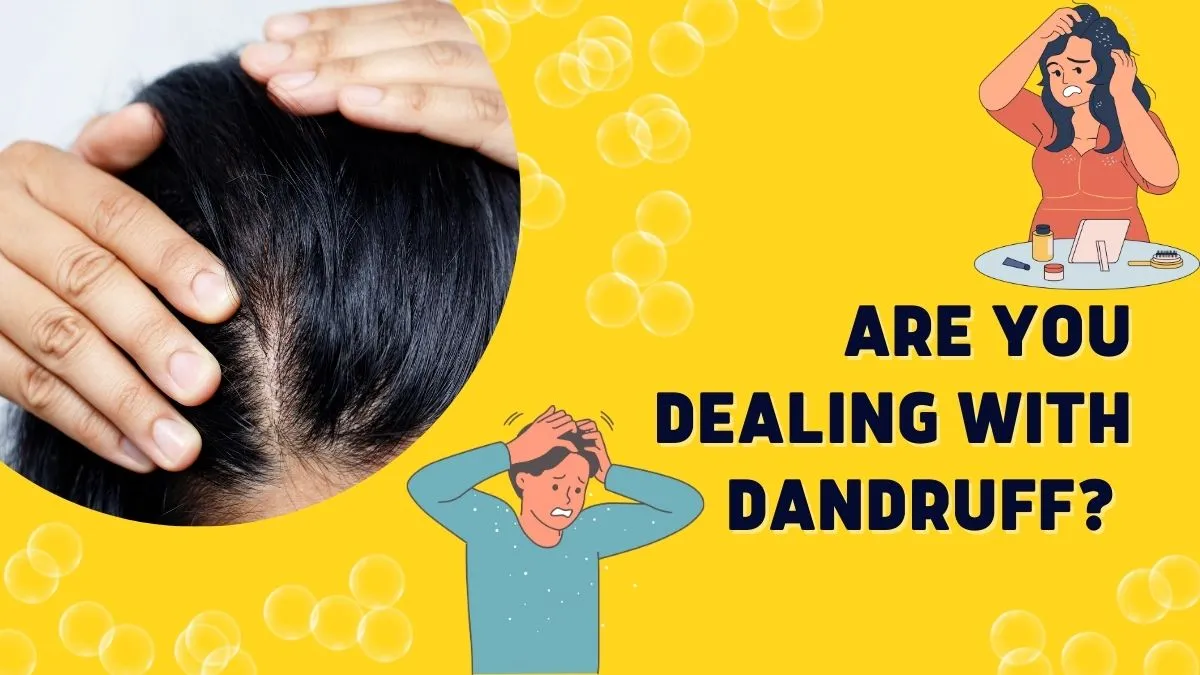 dealing-with-dandruff-top-5-oils-you-can-include-in-your-haircare-for-clean-mane