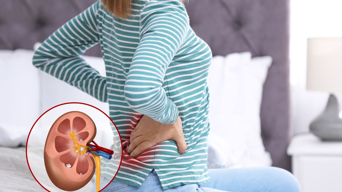 5-effective-tips-to-get-relief-from-excruciating-pain-of-kidney-stones