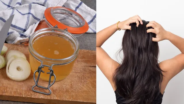 onion-juice-for-hair-growth-ways-to-use-this-home-remedy-to-prevent-hair-fall