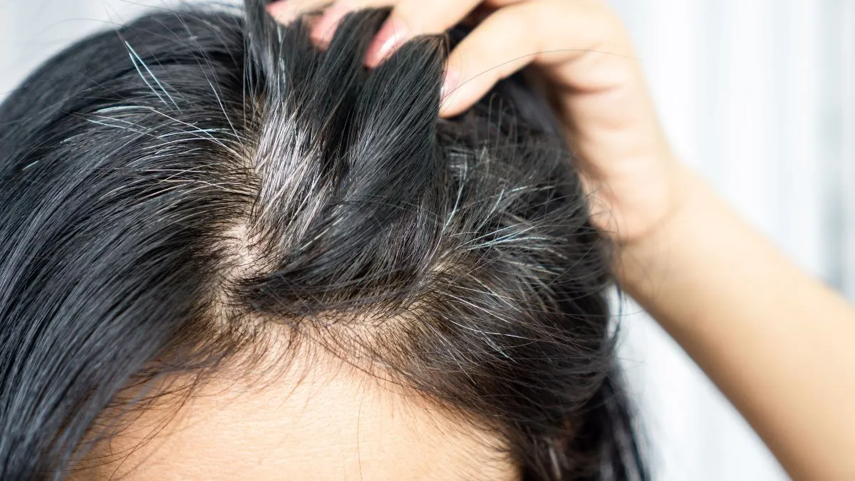 expert-recommended-easy-solutions-to-prevent-premature-grey-hair-at-home