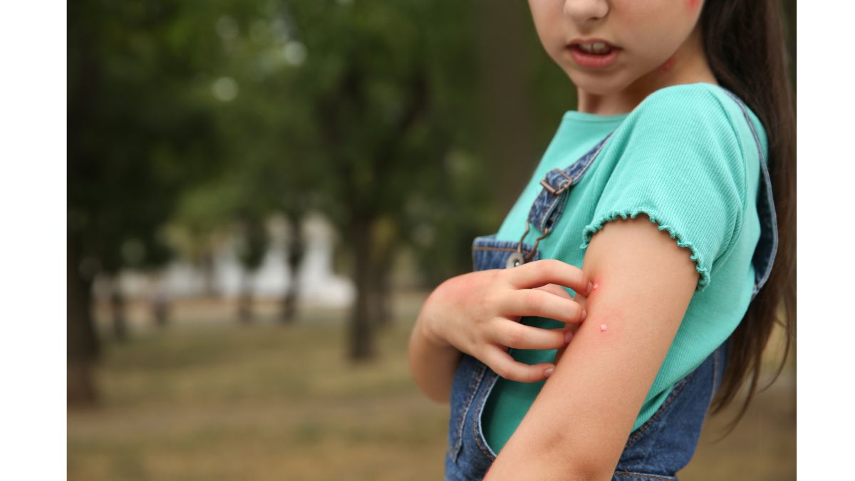 Expert Reveals Dangerous Health Risks Associated With Mosquito Bites