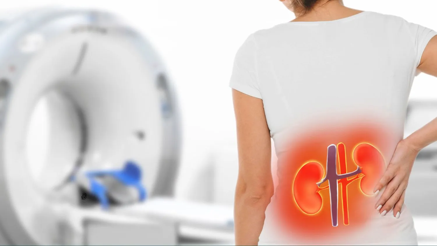 doctor-recommended-simple-lifestyle-tips-to-prevent-kidney-stones-and-boost-health