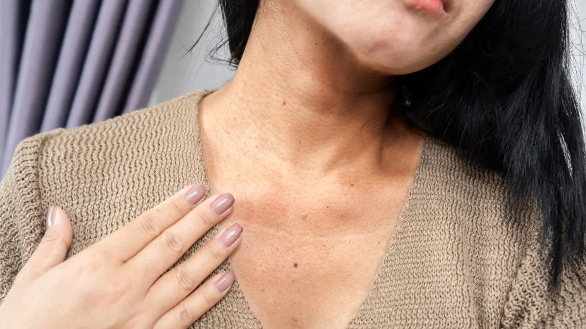 5-must-try-home-remedies-to-get-rid-of-dark-neck-easily