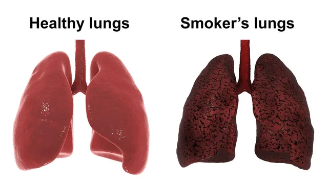 keeping-your-lungs-healthy-know-from-expert-about-all-the-essential-habits-for-optimal-function