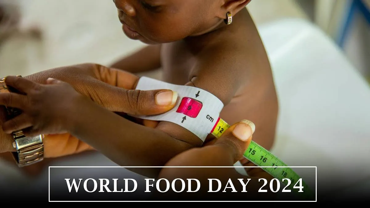 world-food-day-2024-understanding-malnutrition-and-its-global-impact-specials