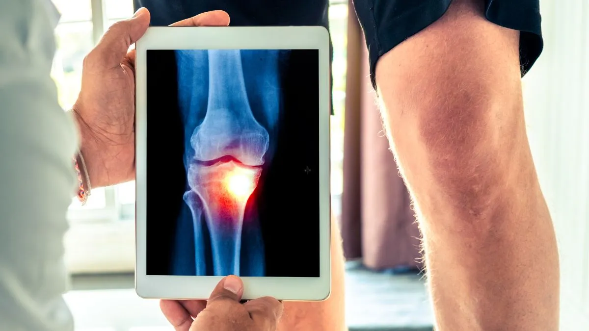 doctor-explains-how-regenerative-medicine-helps-to-restore-mobility-and-quality-life-in-osteoarthritis-patients