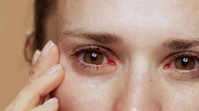 post-festival-eye-care-doctors-recommend-ways-to-manage-eye-irritation-after-diwali