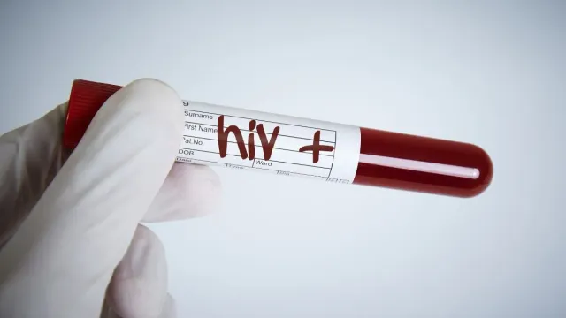 uttarakhand-news-19-men-tests-hiv-positive-after-sexual-engagements-with-same-girl-in-nainital