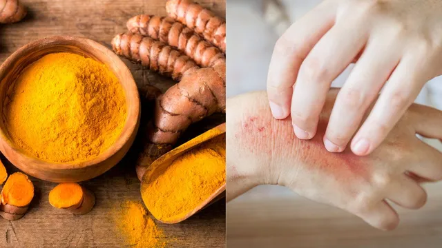 5-foods-that-help-prevent-infections-naturally