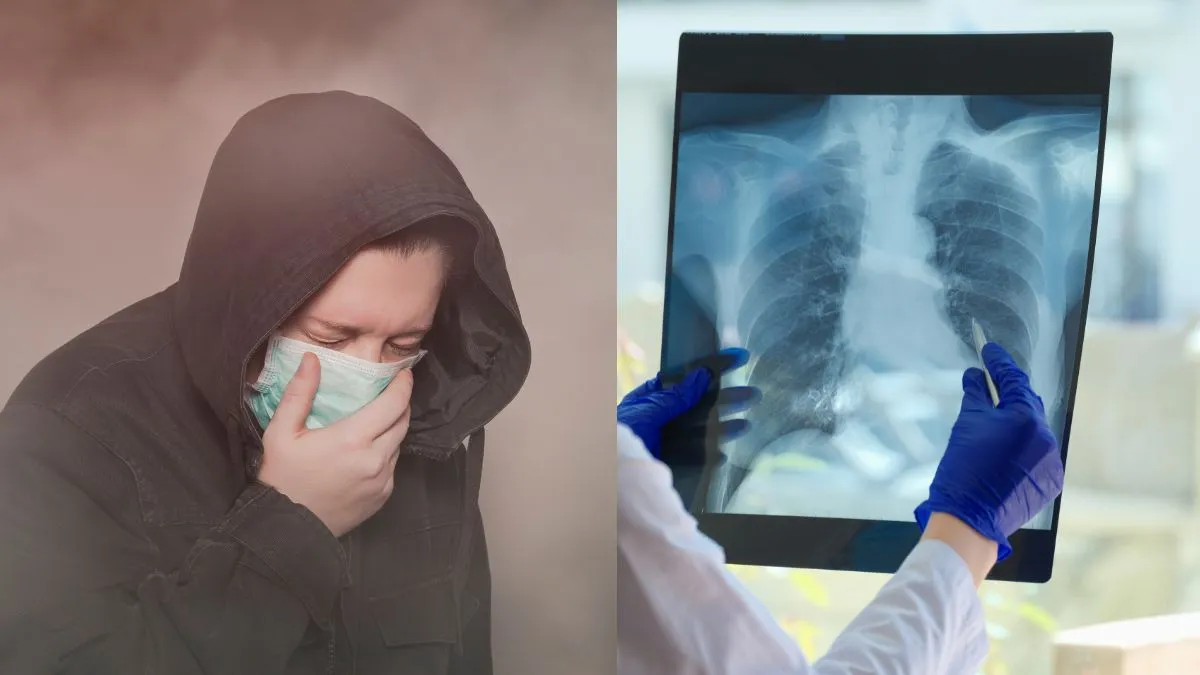 how-is-air-pollution-quietly-contributing-to-rise-of-lung-cancer-cases-expert-explains