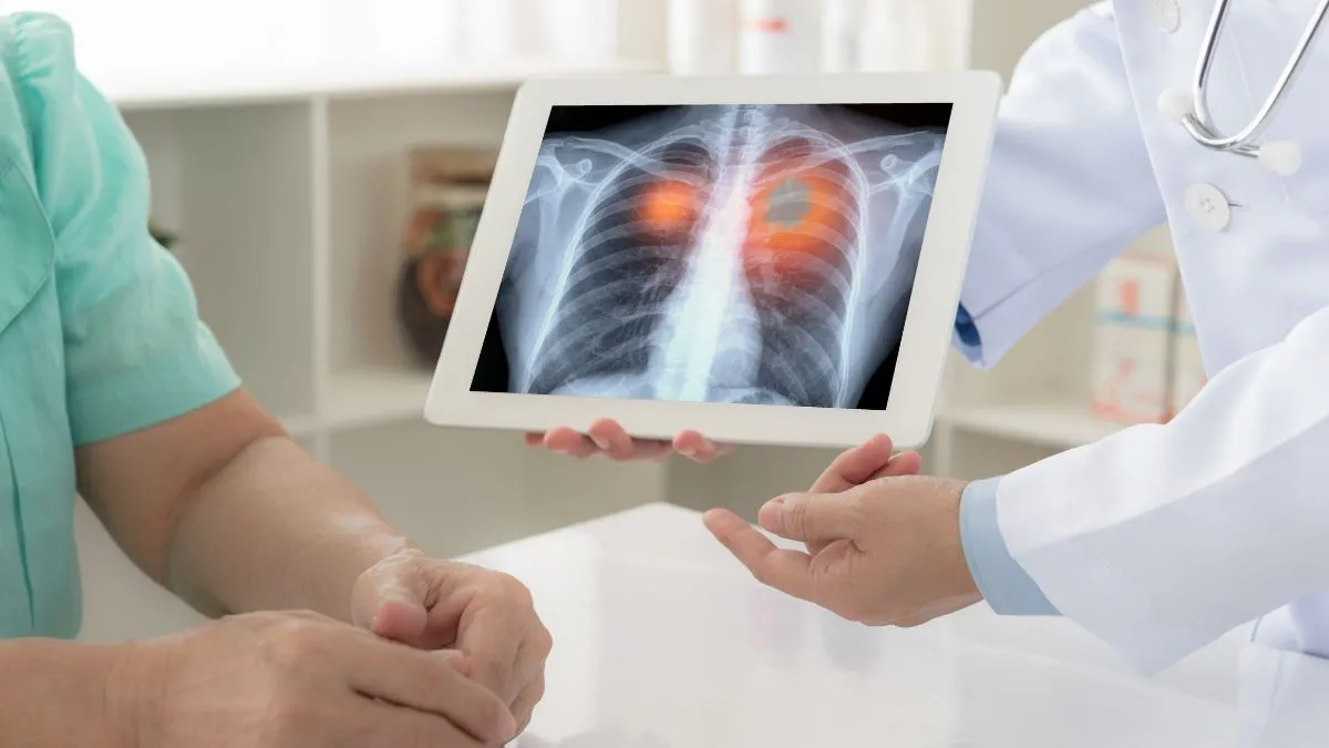 expert-lists-proactive-steps-you-can-take-today-to-lower-your-risk-of-lung-cancer