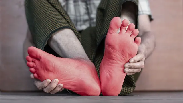 world-diabetes-day-2024-5-early-signs-of-foot-disease-for-diabetics-to-watch-out-for