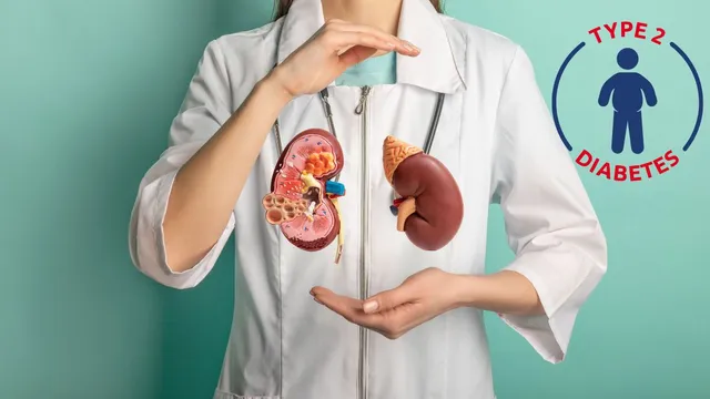 expert-advice-on-why-protecting-kidney-health-is-vital-for-people-with-type-2-diabetes